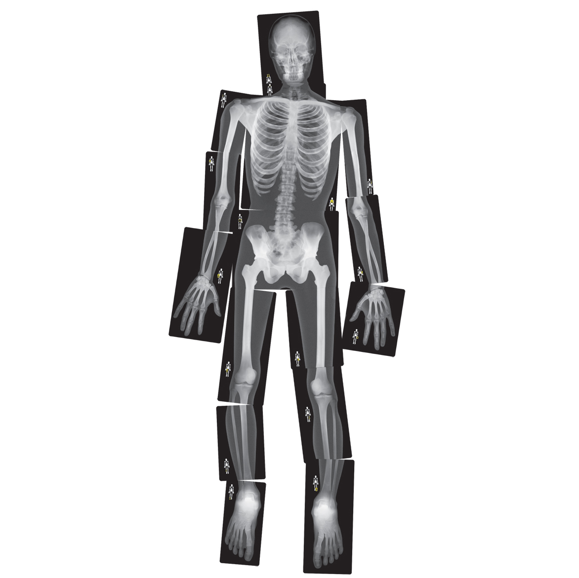 Naturtro menneskelige røntgenbilleder